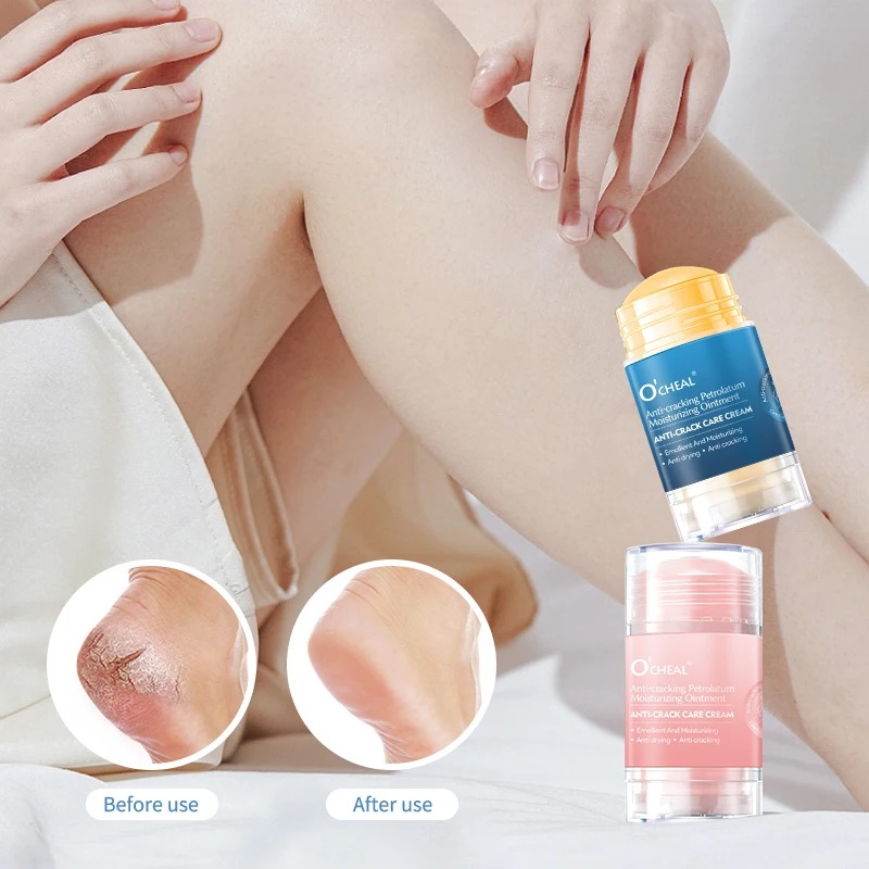 Heels - Creme anti-rachaduras para pés e calcanhares